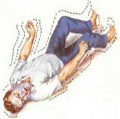 西安的癫痫怎么治疗