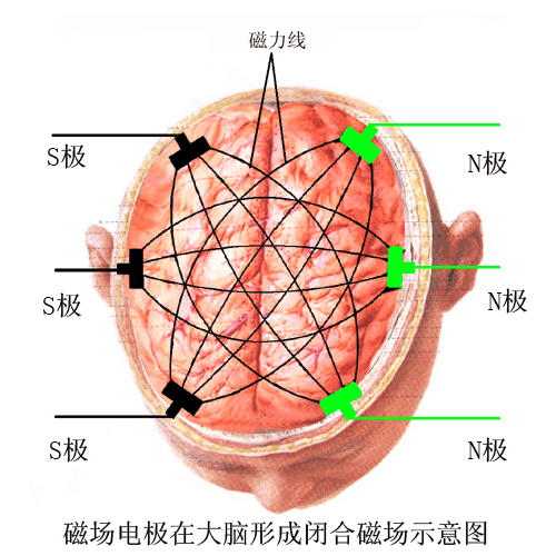 西安癫痫病哪家医院能治